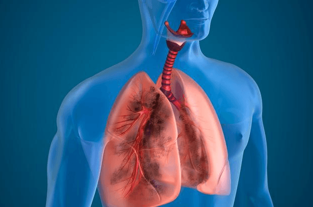 肺癌中晚期最多活多久？