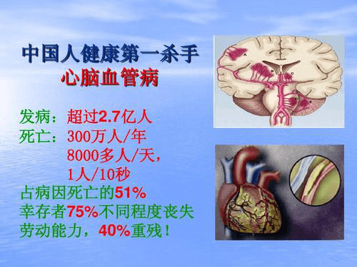 负氧离子